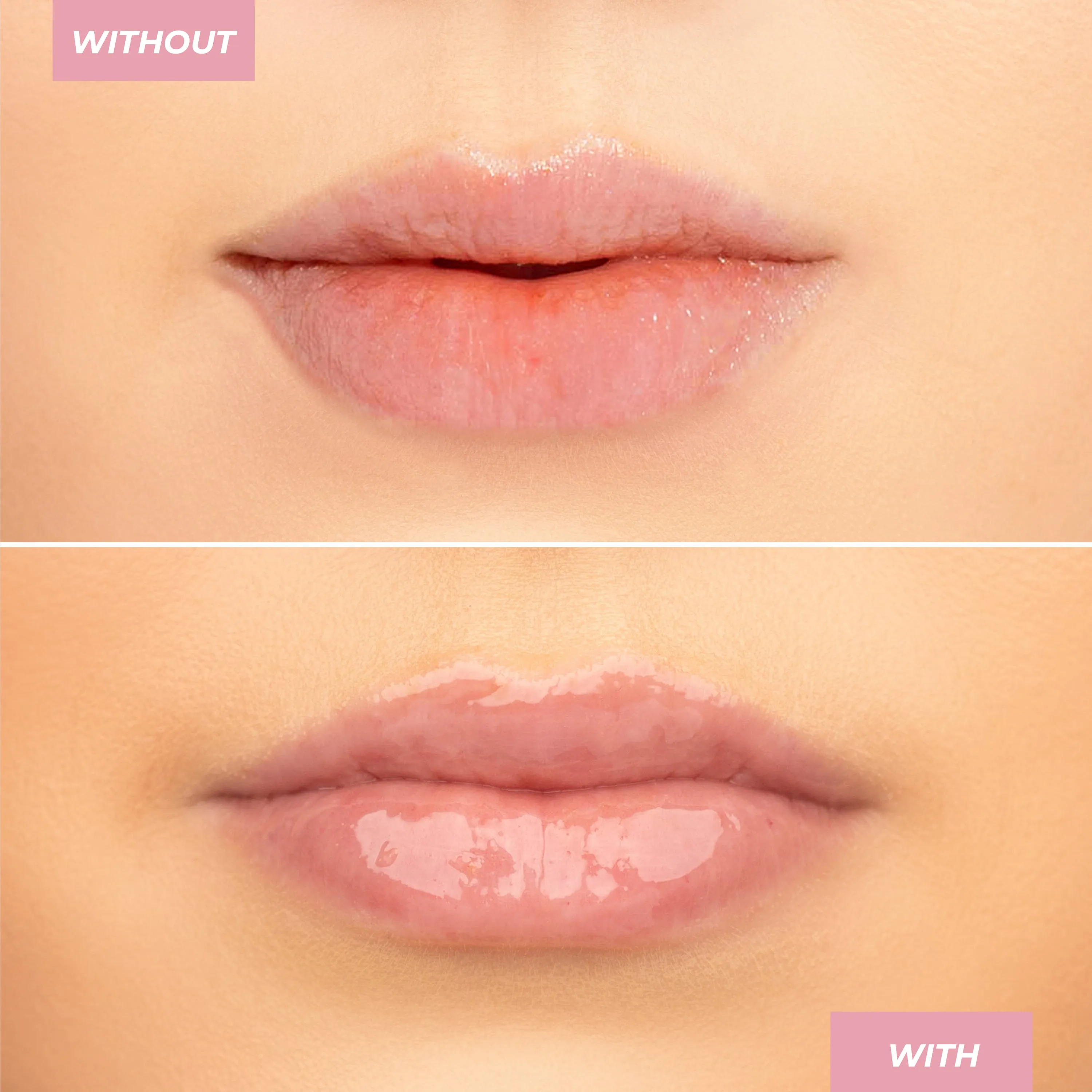 Peptide Lip Treatment